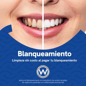 Slider image (10) DrAW Dental Clinic